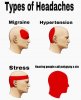 Types of Headaches 14092018233138.jpg